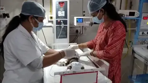 Baby Buried Alive in India Battles for Her Life